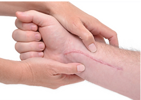 LDM Treatment - 3